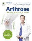 Arthrose Arthrose